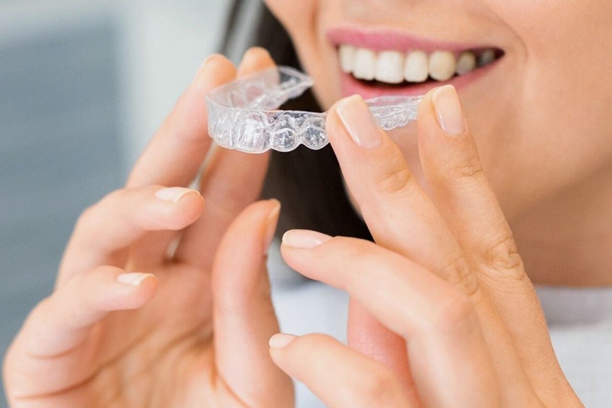 Clear Aligners