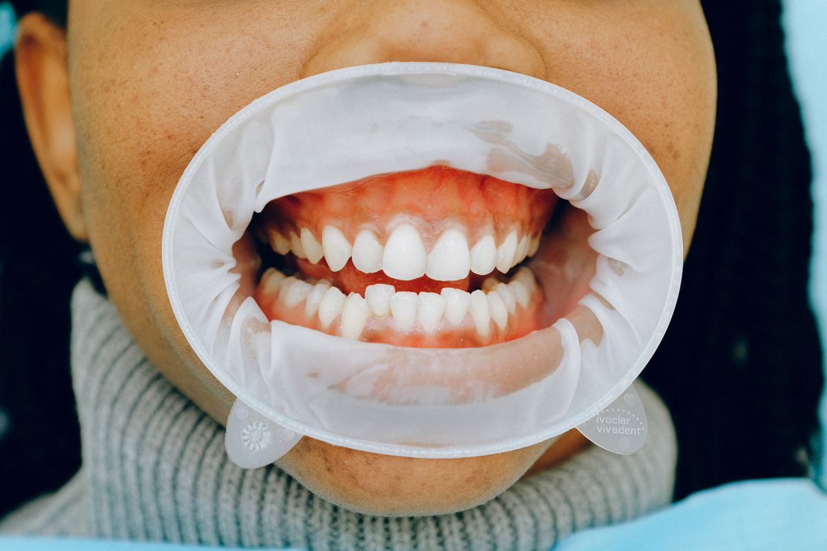 Periodontics