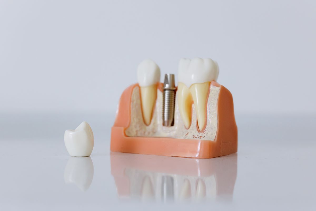 Restorative Dentistry